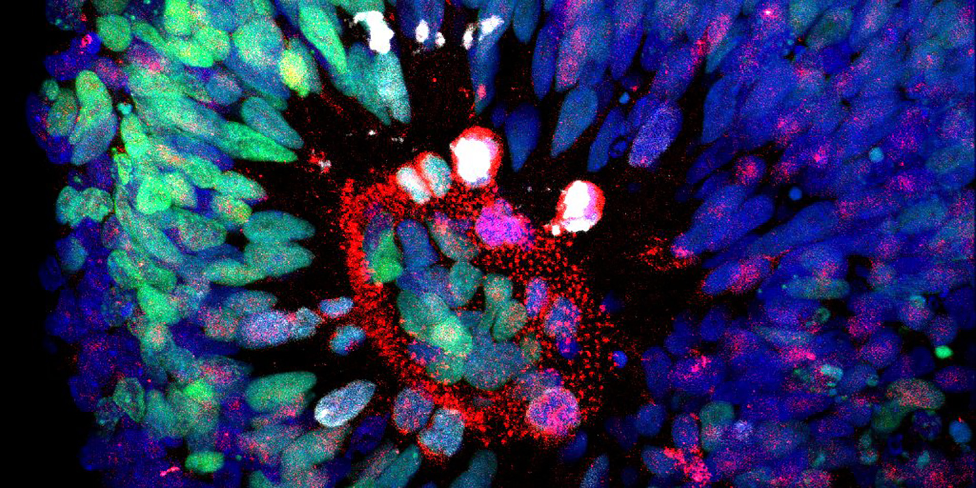 Clown organoid