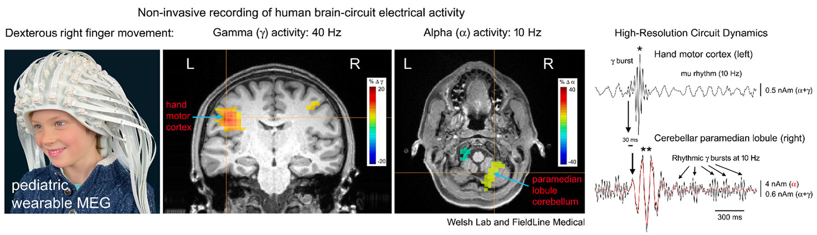 Non-invasive recording of human brain-circuit electrical activity