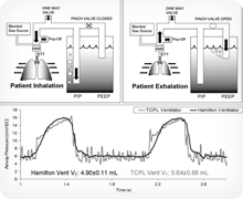 Hansen Ventilator Operational Mechanism Hansen Ventilator Operational Mechanism